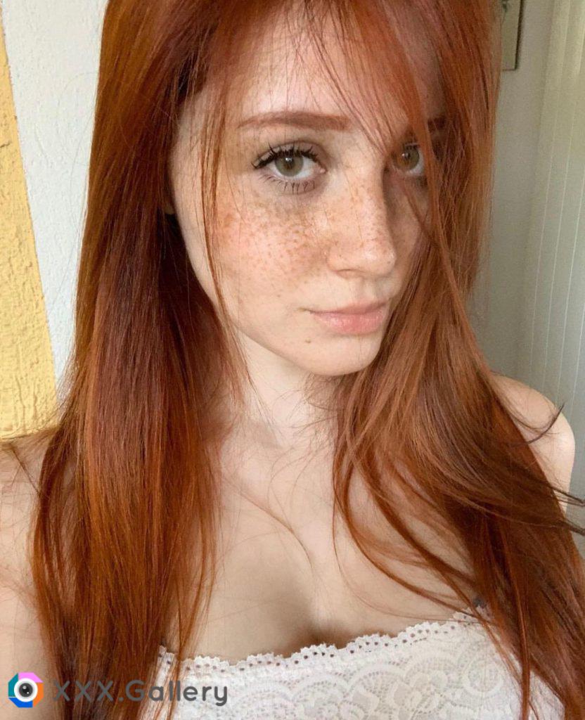 Beautiful freckles